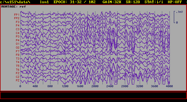 brainwaves.gif (21657 bytes)